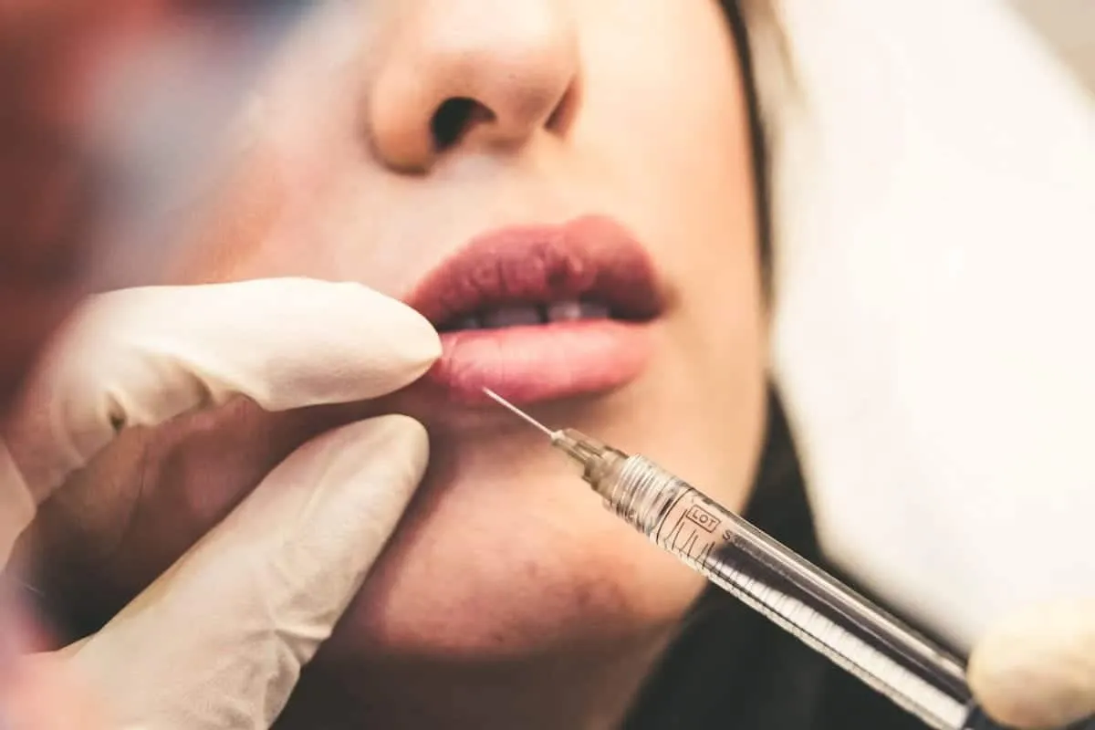 Wat je moet weten voordat je Botox laat zetten